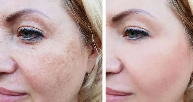 Heba Skin Care Clinic